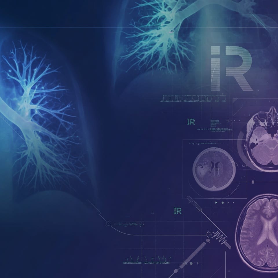 The IR Digest