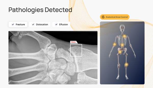 X-Ray AI Software Gets Expanded FDA Clearance for Detecting Joint Effusions and Dislocations
