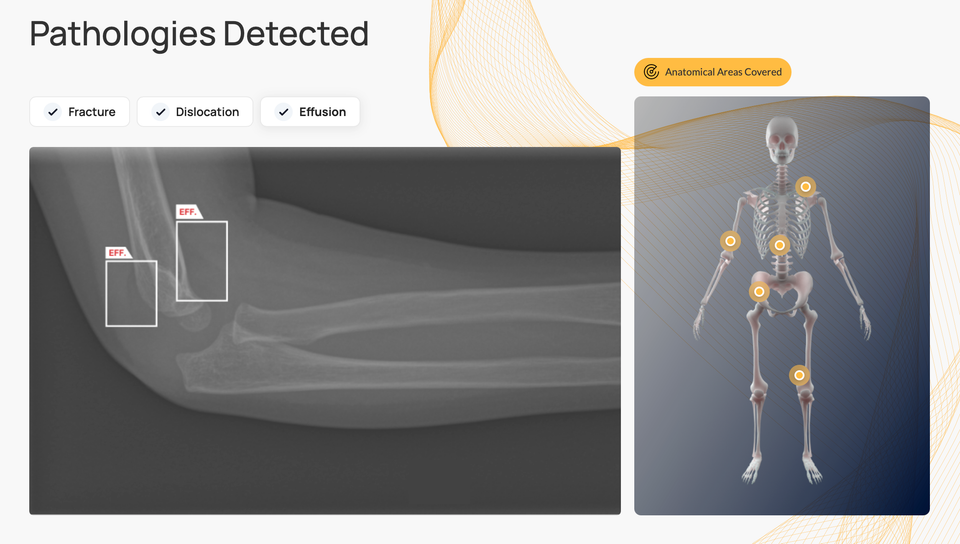X-Ray AI Software Gets Expanded FDA Clearance for Detecting Joint Effusions and Dislocations